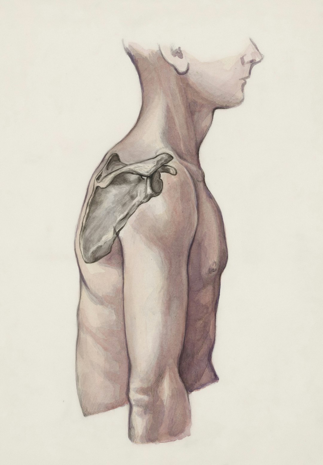 dysmorphia